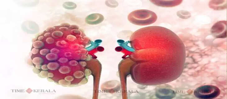 kidney